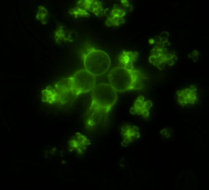 Fluorescence microscopy — live cell imaging